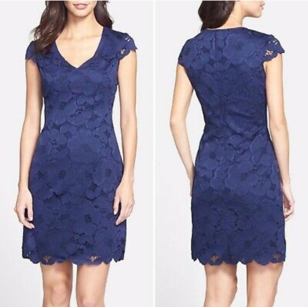 Lilly Pulitzer Navy Lace Dress